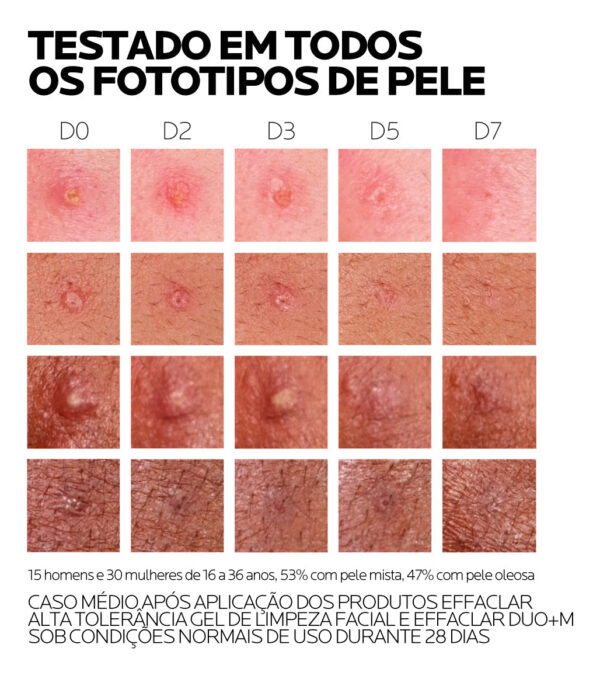 EFFACLAR DUO+ M CREMA ANTIACNE 40ml - Imagem 8